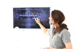 schiefbahn-zahnarztpraxis-wurzelkanalbehandlung
